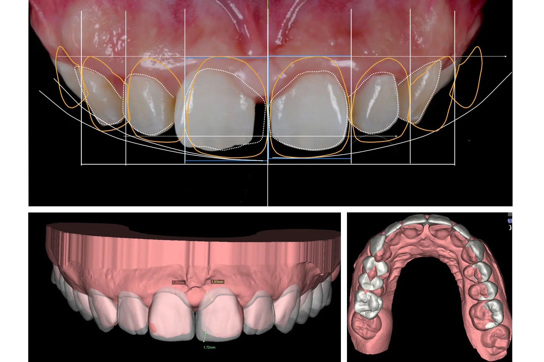 Digital Smile Design