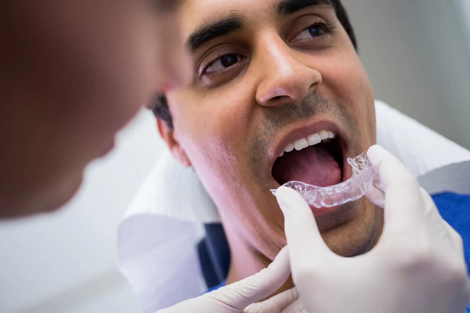 Invisalign clear aligners