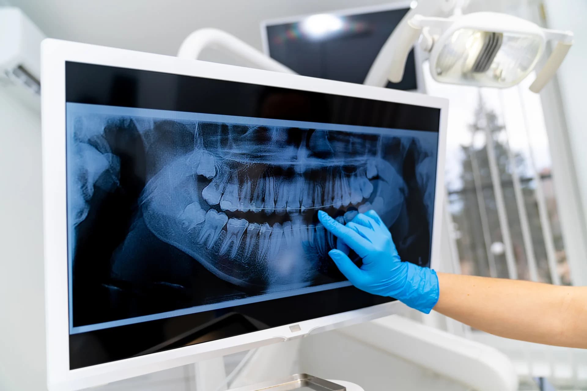 Smile design displayed on monitor