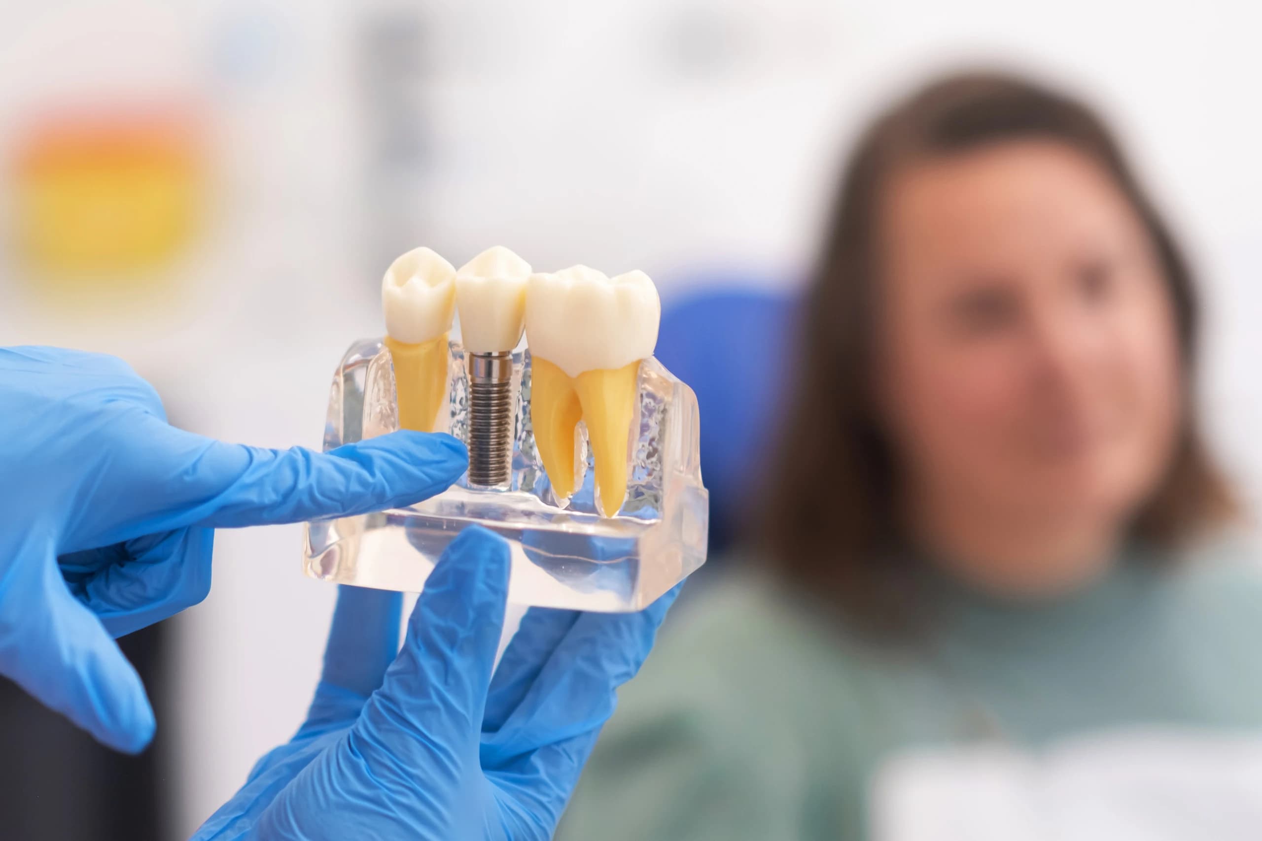 Dental implant model showing tooth replacement procedure