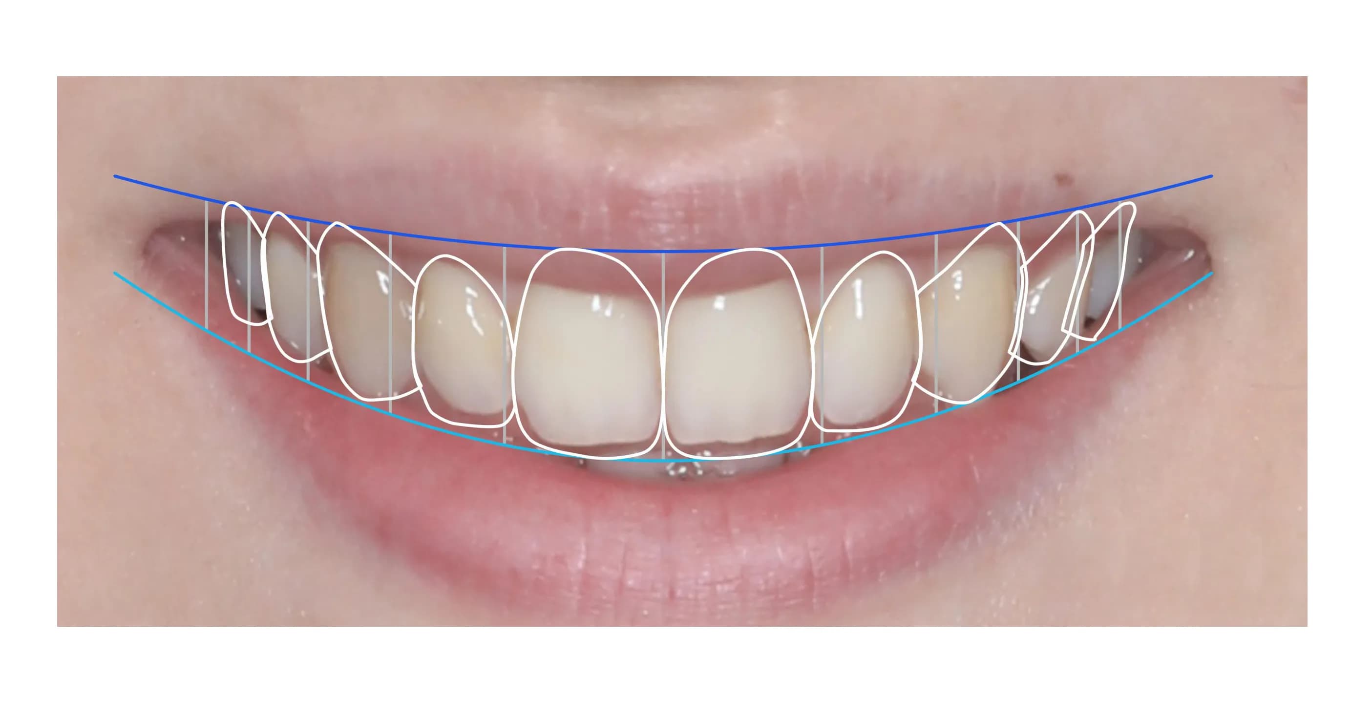 Dentist showing digital dental imaging results to a patient