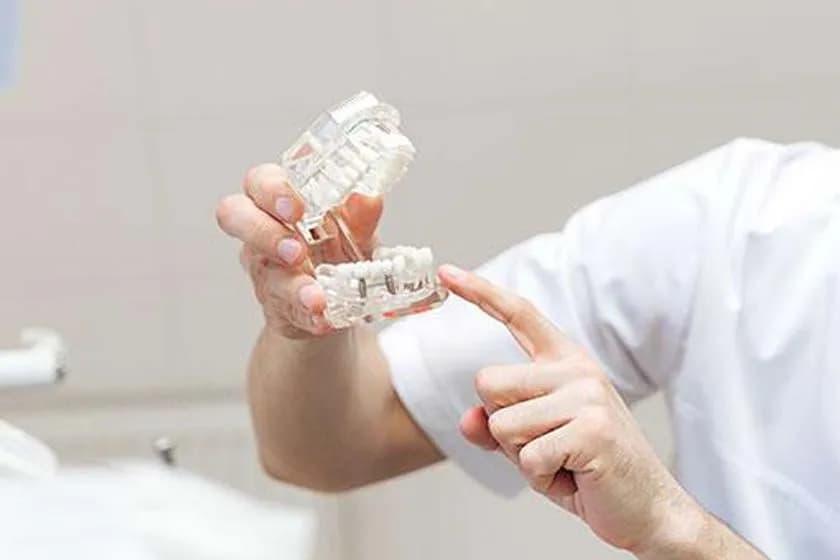 Physical 3D model of proposed smile design