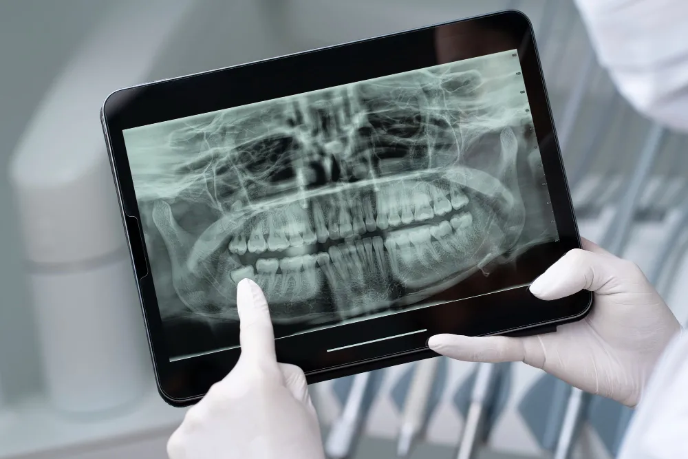Digital dental x-ray assessment for emergency diagnosis