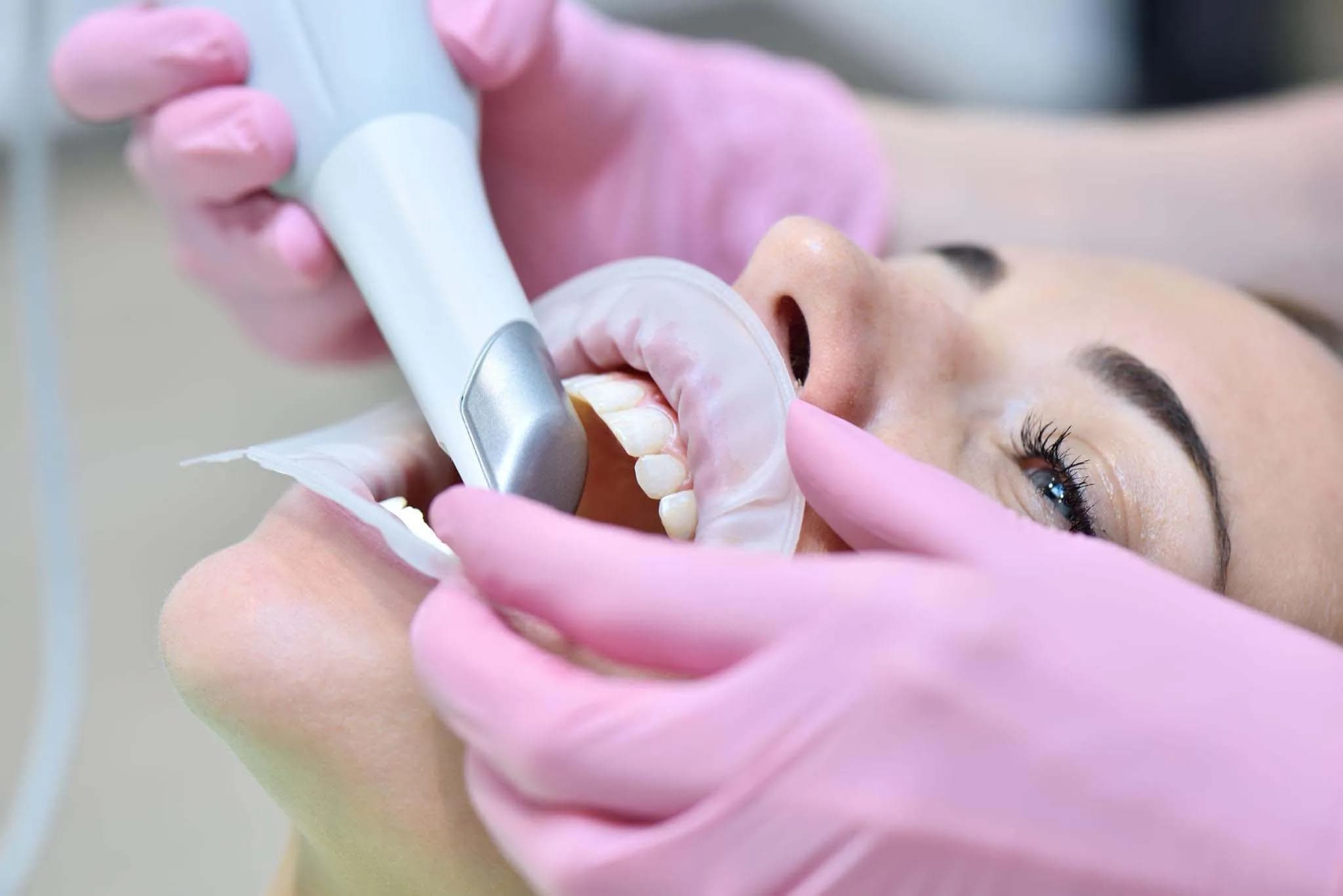 Digital 3D dental scan displayed on screen