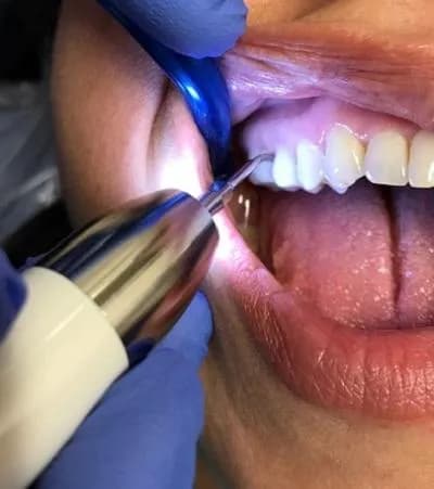 Patient receiving gentle laser dental treatment