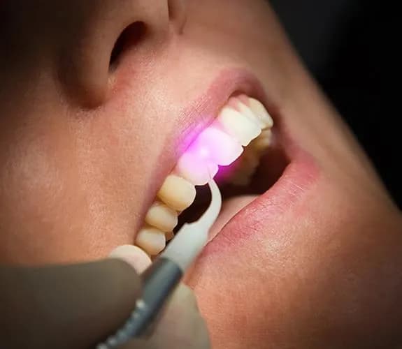 Dental team using laser light during a gentle procedure