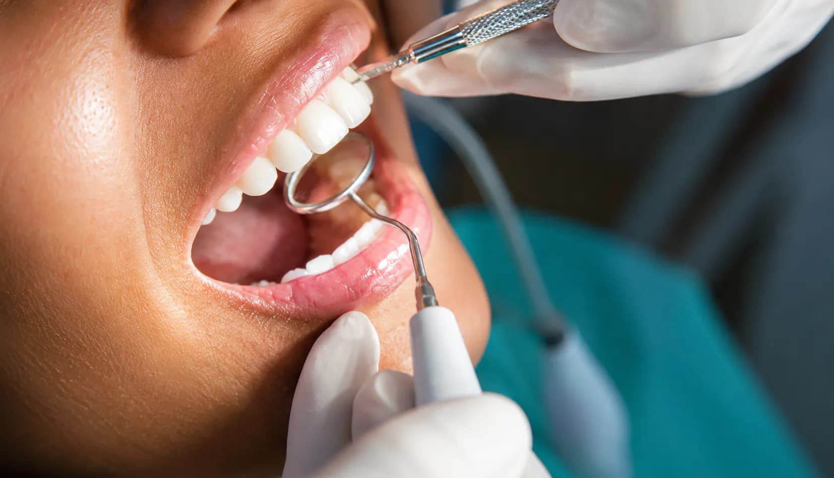 Dental team monitoring gum health at maintenance visit