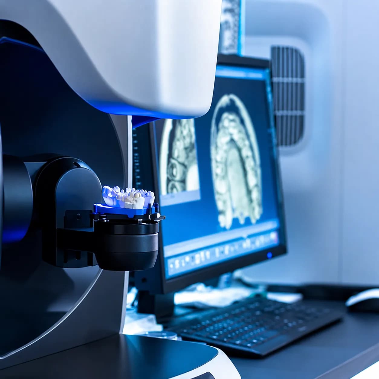 Same-Day 3D-Printed Crowns process