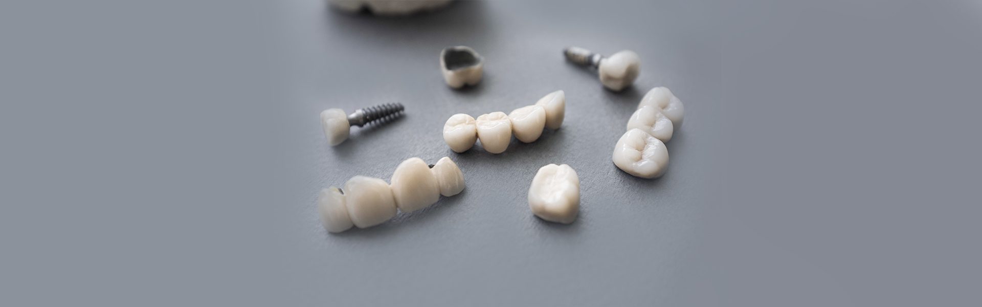 Dental Crowns Vs. Dental Filling: Which is Better?